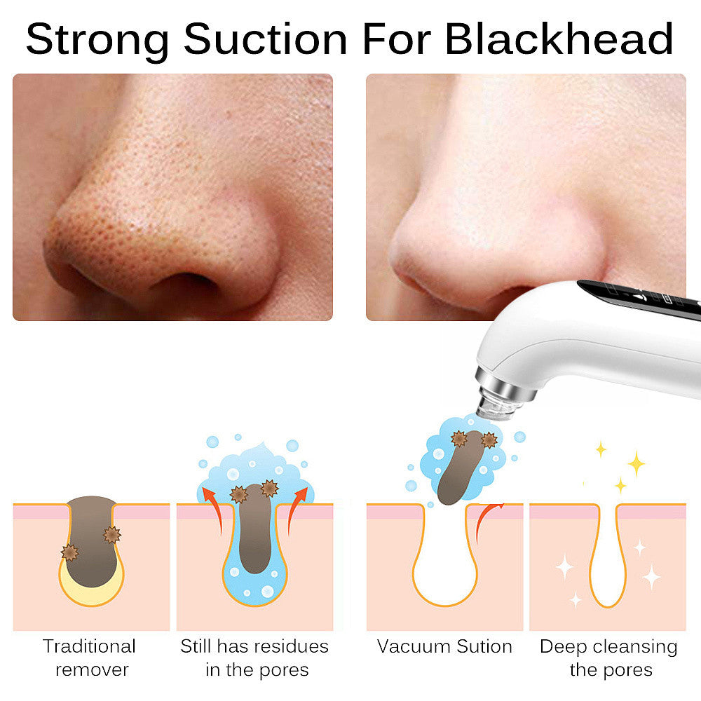 Skin Cleansing Oxygenation Cleanser Beauty Electric Blackhead Suction Instrument
